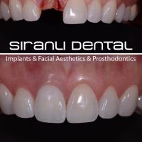 Siranli Implants & Facial Aesthetics image 8